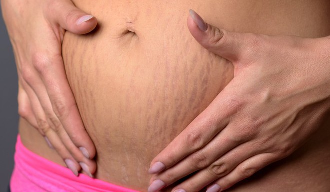 9 thay đổi của cơ thể sau khi sinh có thể nhiều mẹ sẽ sốc - Ảnh 2.