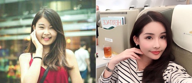 Tháo sụn mũi đơn giản thế này, chẳng trách HH Đại Dương và nhiều người đẹp Việt lại sở hữu chiếc mũi mỗi ngày - Ảnh 1. Tháo sụn mũi đơn giản thế này, chẳng trách HH Đại Dương và nhiều người đẹp Việt lại sở hữu chiếc mũi mỗi ngày - Ảnh 1.