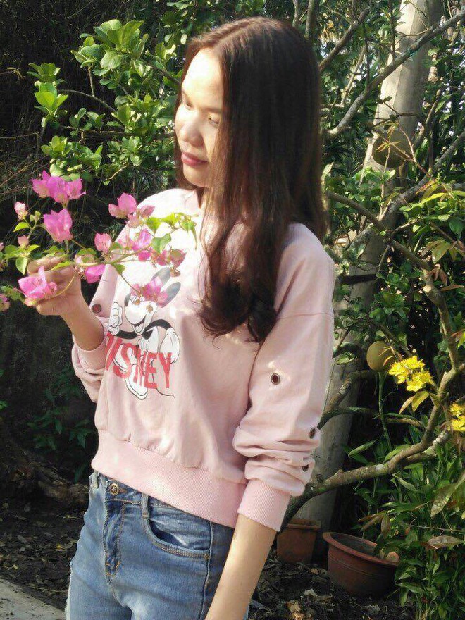 Làm đẹp dại cô nàng xinh đẹp rước hại vào thân: da bỏng hoàn toàn, vướng tin đồn giật chồng nên bị tạt axit - Ảnh 3. Làm đẹp dại cô nàng xinh đẹp rước hại vào thân: da bỏng hoàn toàn, vướng tin đồn giật chồng nên bị tạt axit - Ảnh 3.