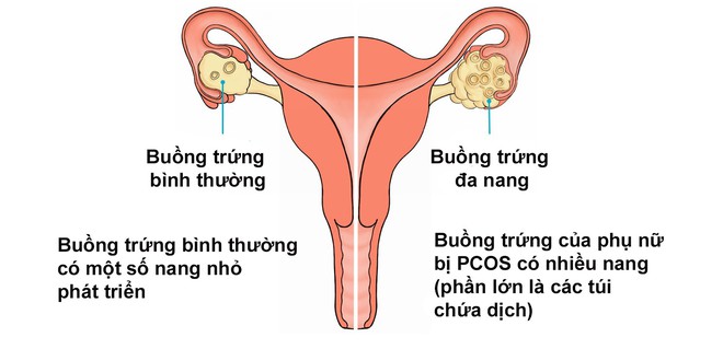 Chia sẻ của 3 người phụ nữ về căn bệnh phụ khoa tiềm ẩn mà lại không chữa được này khiến không ít chị em giật mình - Ảnh 4.