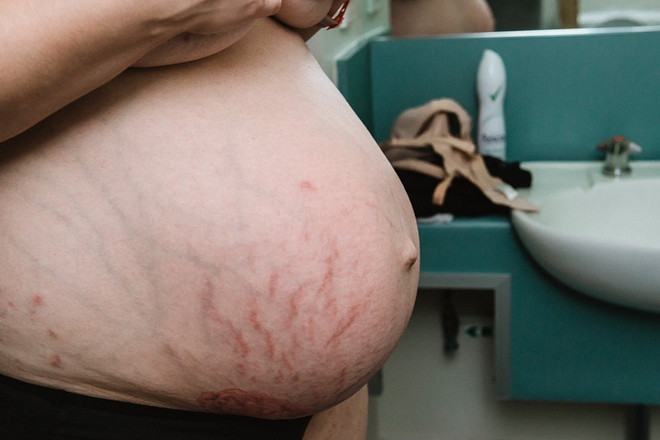 Không phải đang mang thai đâu, đây là cơ thể người phụ nữ vài giờ sau sinh đấy - Ảnh 2.