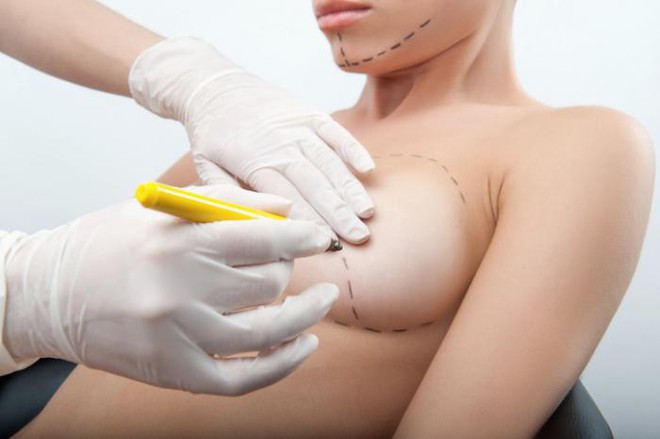 Bác sĩ thẩm mỹ có kinh nghiệm 10 năm: Phẫu thuật nâng ngực có biến chứng, tụ máu là hết sức bình thường? - Ảnh 1.