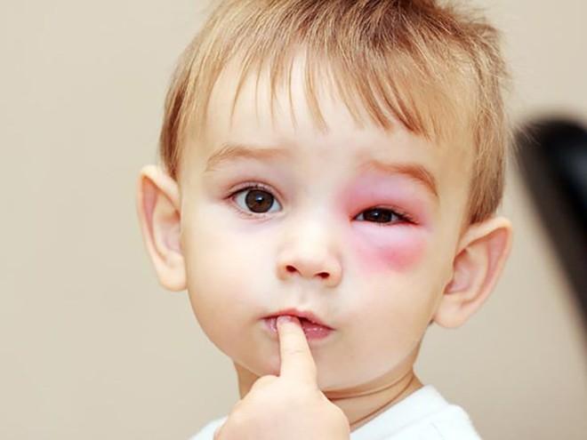 Các triệu chứng của căn bệnh ung thư nguy hiểm nhất ở trẻ em - Ảnh 9.