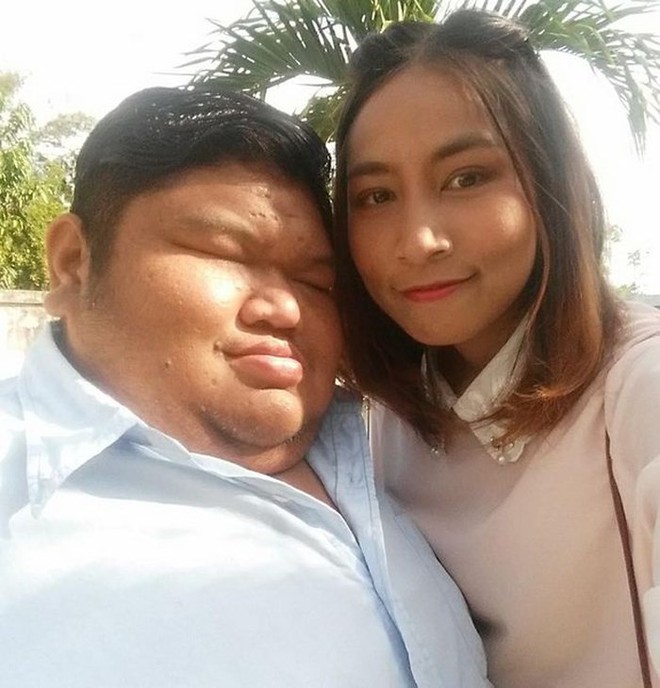 Câu chuyện tình yêu vượt qua mọi giới hạn của cặp đôi đũa lệch chồng xấu vợ xinh này sẽ giúp bạn có thêm niềm tin vào tình yêu - Ảnh 1.