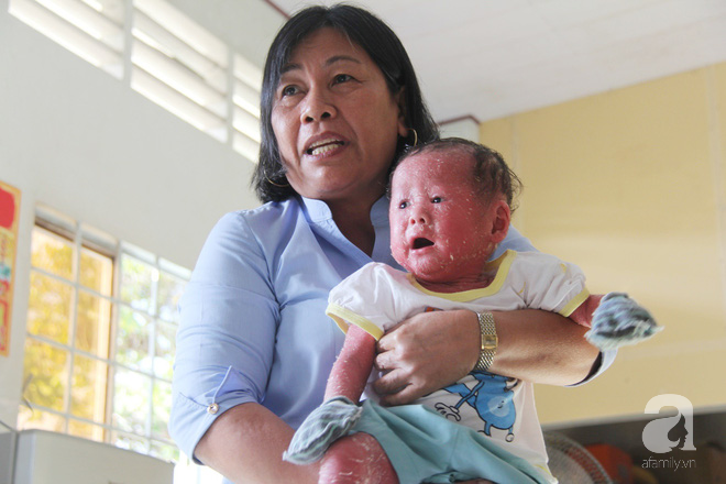 Rớt nước mắt bé gái 14 tháng tuổi người như da trăn, nổi vẩy ngứa bị bố mẹ bỏ rơi mà không có tiền chữa trị - Ảnh 7.