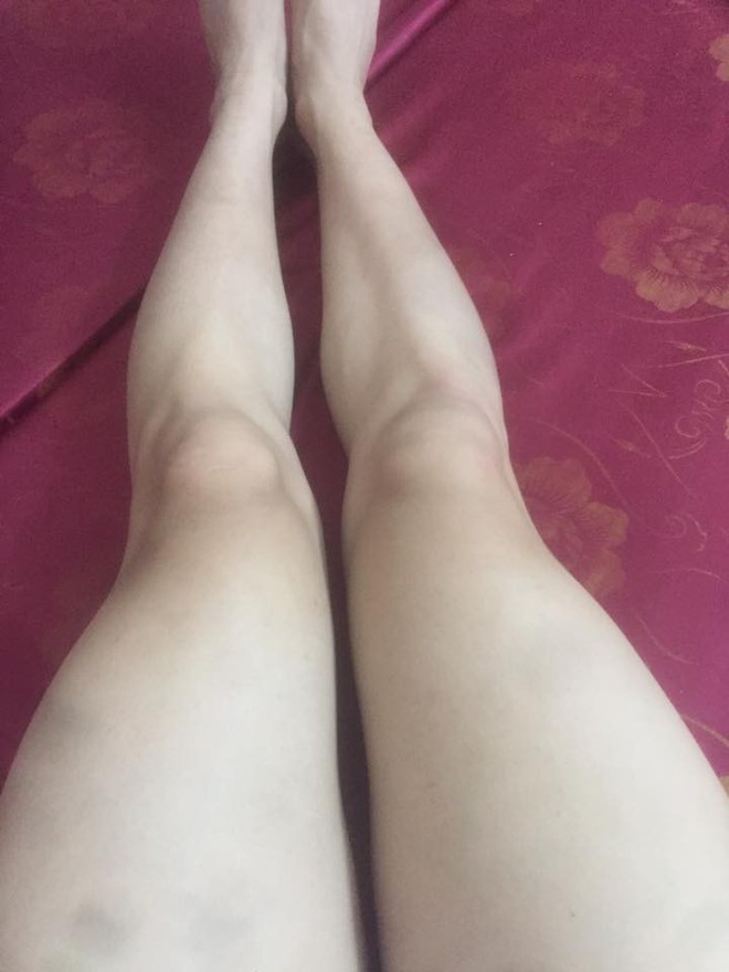 Có một nỗi khổ mang tên con trai mà chân tay không một cọng lông, láng mịn hơn cả con gái - Ảnh 8.