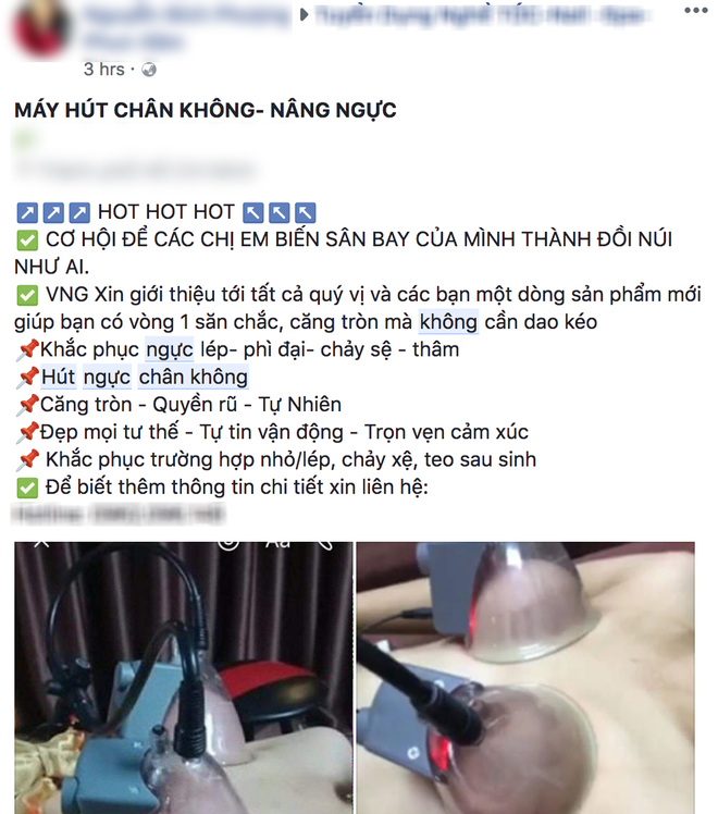 Thực hư phương pháp nâng ngực bằng máy hút, biến sân bay thành đồi núi đang được các chị em chia sẻ rầm rộ - Ảnh 4. Thực hư phương pháp nâng ngực bằng máy hút, biến sân bay thành đồi núi đang được các chị em chia sẻ rầm rộ - Ảnh 4.