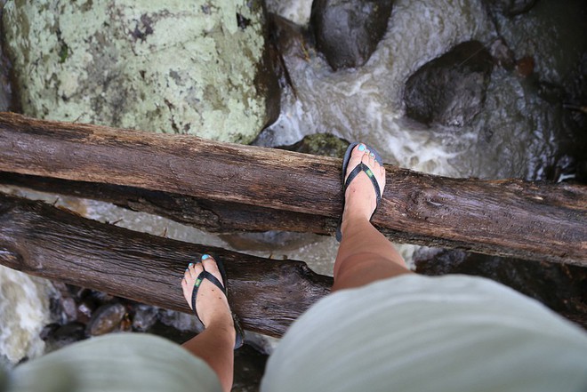Đôi dép tông mùa hè có thể đang ảnh hưởng đôi chân của bạn theo những cách này - Ảnh 2.