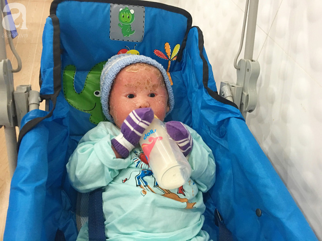 Ca sĩ Lam Trường đến thăm bé Bích - em bé bị vẩy ngứa da trăn trước khi bé nhập viện điều trị - Ảnh 12.