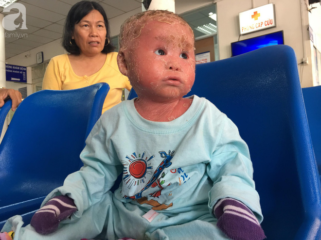 Ca sĩ Lam Trường đến thăm bé Bích - em bé bị vẩy ngứa da trăn trước khi bé nhập viện điều trị - Ảnh 13.