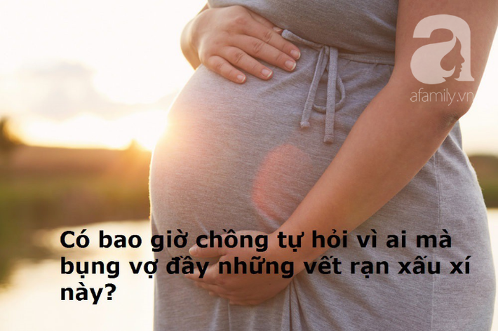 Sinh con một năm mà chồng vẫn chẳng đả động chuyện chăn gối, tôi làm liều gạ gẫm thì chồng nói một câu như sét đánh ngang tai! - Ảnh 2.