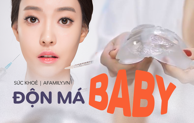 Muốn độn má baby trẻ ra cả chục tuổi mà không bị hoại tử, chuyên gia chỉ ra lưu ý cho từng phương pháp