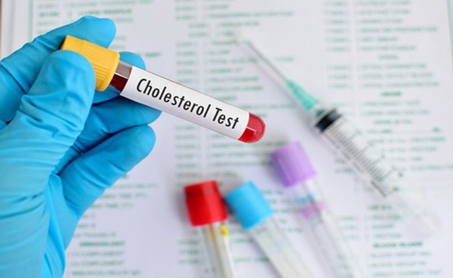 Báo động người Việt Nam thừa Cholesterol - Ảnh 1.