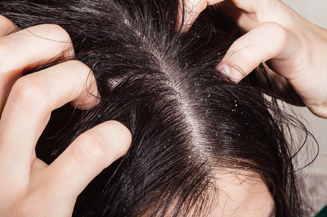 Chủ salon tóc người Hàn chỉ ra sai lầm hủy hoại tóc khi gội đầu: Gái Hàn không bao giờ mắc phải vì hại tóc cực kỳ - Ảnh 3. Chủ salon tóc người Hàn chỉ ra sai lầm hủy hoại tóc khi gội đầu: Gái Hàn không bao giờ mắc phải vì hại tóc cực kỳ - Ảnh 3.