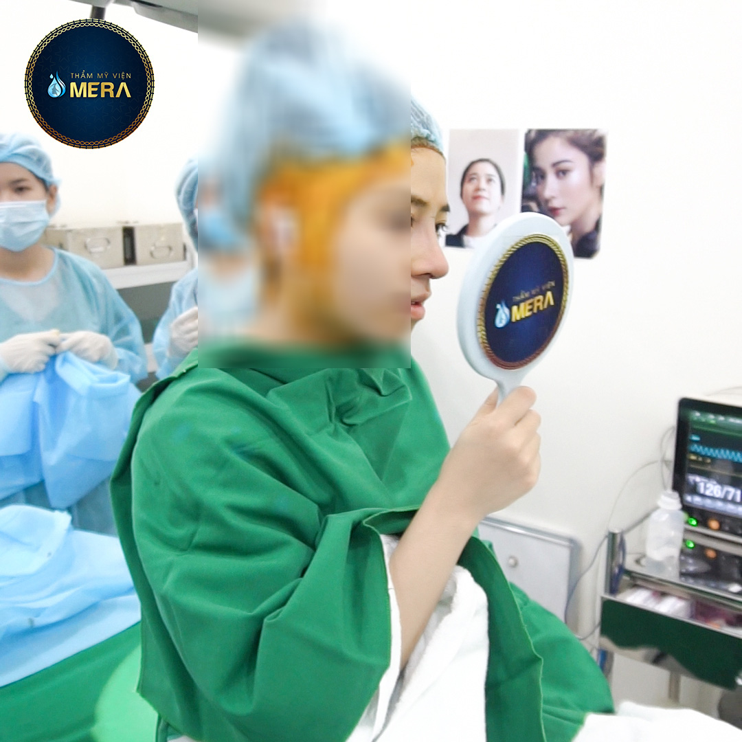 Nâng mũi an toàn với phương pháp cấu trúc tại TMV MERA - Ảnh 3. Nâng mũi an toàn với phương pháp cấu trúc tại TMV MERA - Ảnh 3.