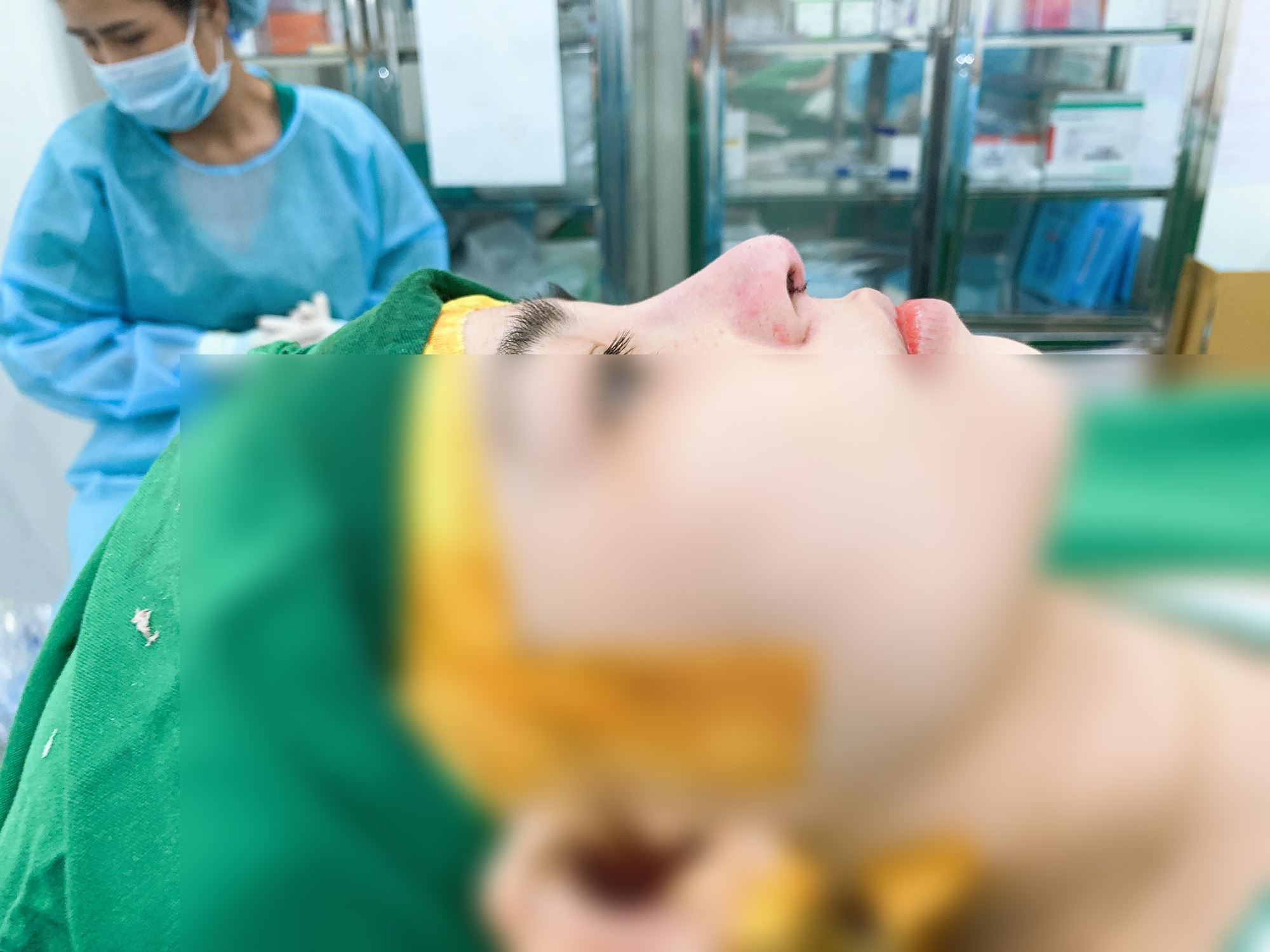 Nâng mũi an toàn với phương pháp cấu trúc tại TMV MERA - Ảnh 4. Nâng mũi an toàn với phương pháp cấu trúc tại TMV MERA - Ảnh 4.