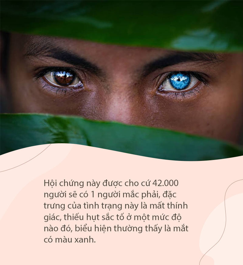 Hội chứng di truyền hiếm gặp khiến bộ tộc người Indonesia này có đôi mắt màu xanh phát sáng - Ảnh 2. Hội chứng di truyền hiếm gặp khiến bộ tộc người Indonesia này có đôi mắt màu xanh phát sáng - Ảnh 2.