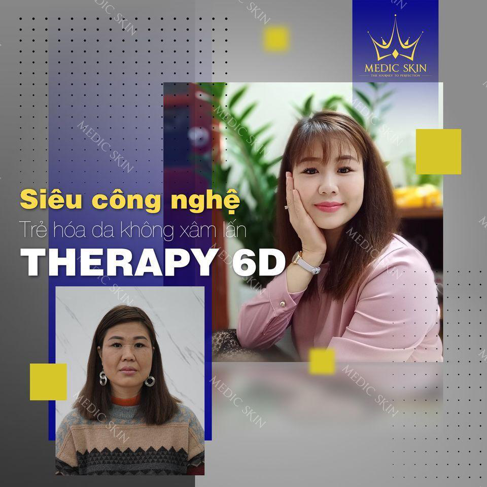 Therapy 6D công nghệ trẻ hóa làm mờ nếp nhăn hàng đầu Việt Nam - Ảnh 1.