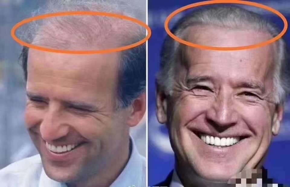 76 Tuá»•i Váº«n Phong Ä'á»™ Lá»‹ch Lam Ong Joe Biden Ä'á»ƒ Lá»™ Báº±ng Chá»©ng Nhiá»u Láº§n Pháº«u Thuáº­t Niu Keo Tuá»•i Xuan Tá»« Cáº¥y Toc CÄƒng Da Ä'áº¿n Cáº¯t Mi