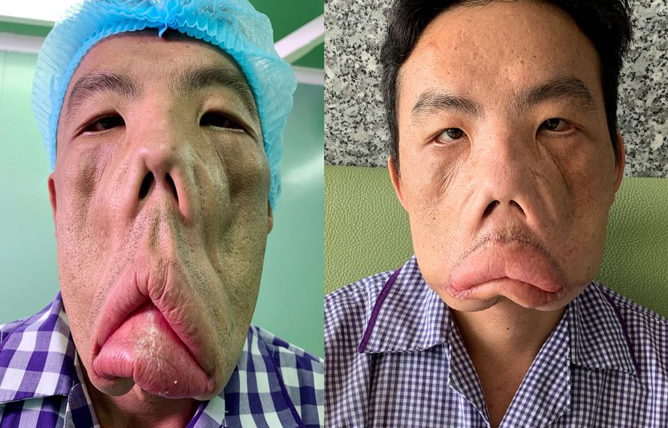Bác sĩ Tú Dung: “Nếu sự nỗ lực mang lại cuộc sống cho một người, tôi nguyện ý” - Ảnh 5.
