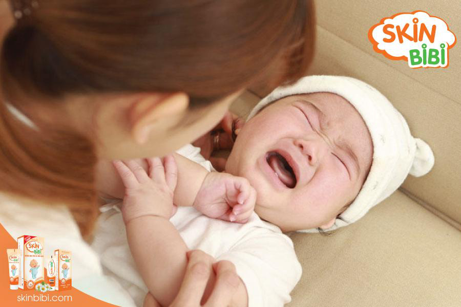SkinBiBi - Bảo bối chống hăm t&atilde; m&ugrave;a lạnh cho b&eacute; - Ảnh 1.