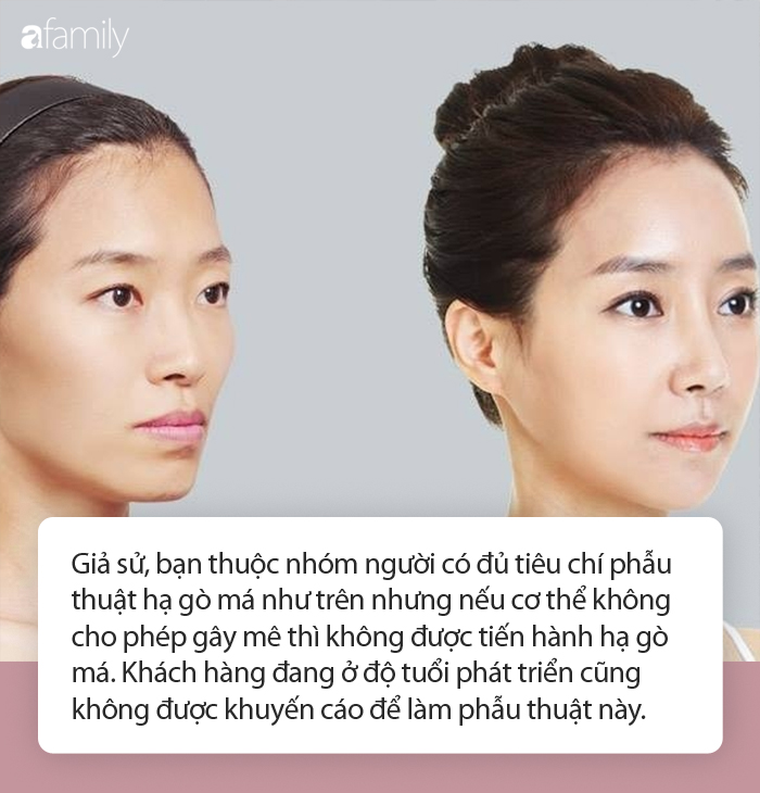 Chỉ cần bỏ ra số tiền kh&ocirc;ng qu&aacute; lớn để hạ g&ograve; m&aacute; tốt đủ đường phong thủy nhưng chuy&ecirc;n gia lưu &yacute; chưa chắc bạn đ&atilde; l&agrave; đối tượng ph&ugrave; hợp  - Ảnh 2.