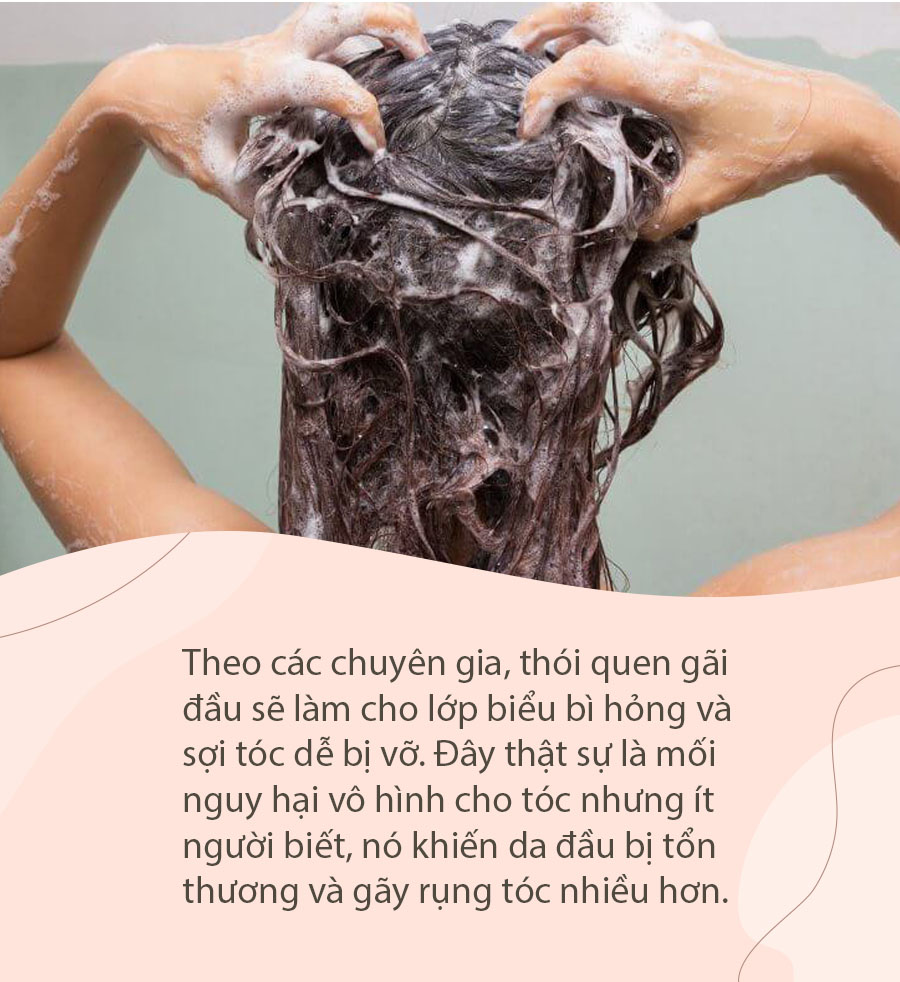 Top 5 Dầu Gội Ngăn Ngừa Rụng Tóc Tốt Nhất Chuyên Gia Khuyên Dùng #29 Top 5 Dầu Gội Ngăn Ngừa Rụng Tóc Tốt Nhất Chuyên Gia Khuyên Dùng
