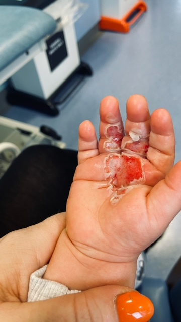 Mẹ vừa quay lưng đi thì nghe tiếng con hét thất thanh, hóa ra cả bàn tay bé bị "nuốt chửng" bởi món đồ nhà nào cũng có