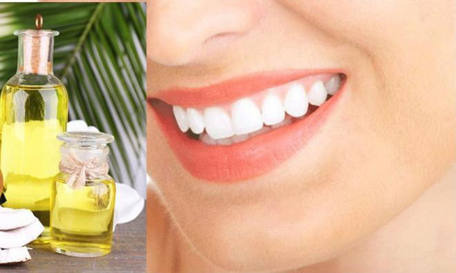 Các phương pháp tẩy trắng răng hiệu quả ai cũng nên biết - Ảnh 3.
