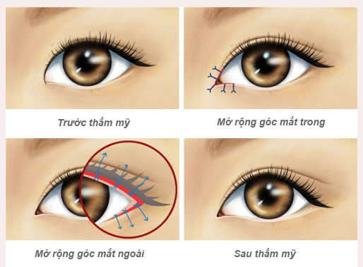 Mở góc mắt: Người sở hữu mắt một mí, mắt nhỏ, mắt ngắn hãy &quot;bơi&quot; hết vào đây! - Ảnh 5.