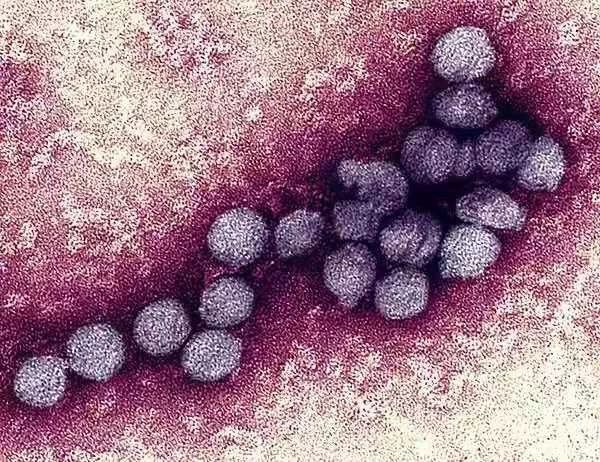 Thợ săn Virus: Những người đầu tiên tìm ra danh tính virus lạ, luôn phải đối mặt với sự nguy hiểm và hàng loạt áp lực từ công chúng - Ảnh 2.