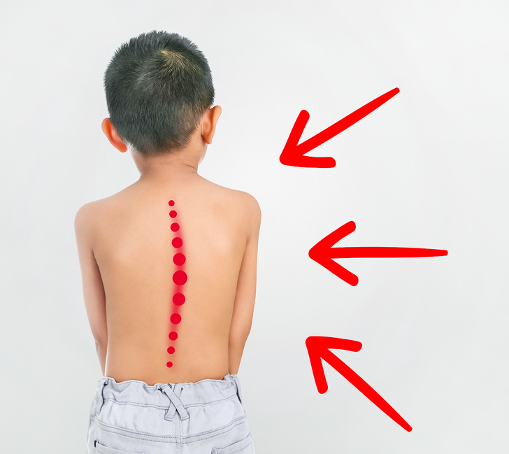 Cứ ngỡ con đi nhón chân là chuyện bình thường, ai ngờ đây lại là dấu hiệu cảnh báo sức khỏe của trẻ - Ảnh 3. Cứ ngỡ con đi nhón chân là chuyện bình thường, ai ngờ đây lại là dấu hiệu cảnh báo sức khỏe của trẻ - Ảnh 3.