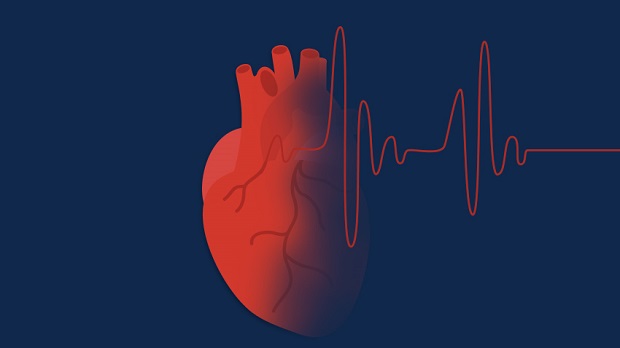 Những dấu hiệu thầm lặng cảnh báo nguy cơ đau tim - Ảnh 3.