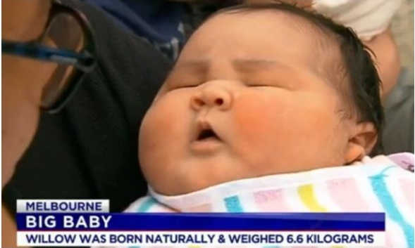 Một bà mẹ hạ sinh thành công cô con gái nặng 6,6kg bằng phương pháp sinh thường - Ảnh 2.