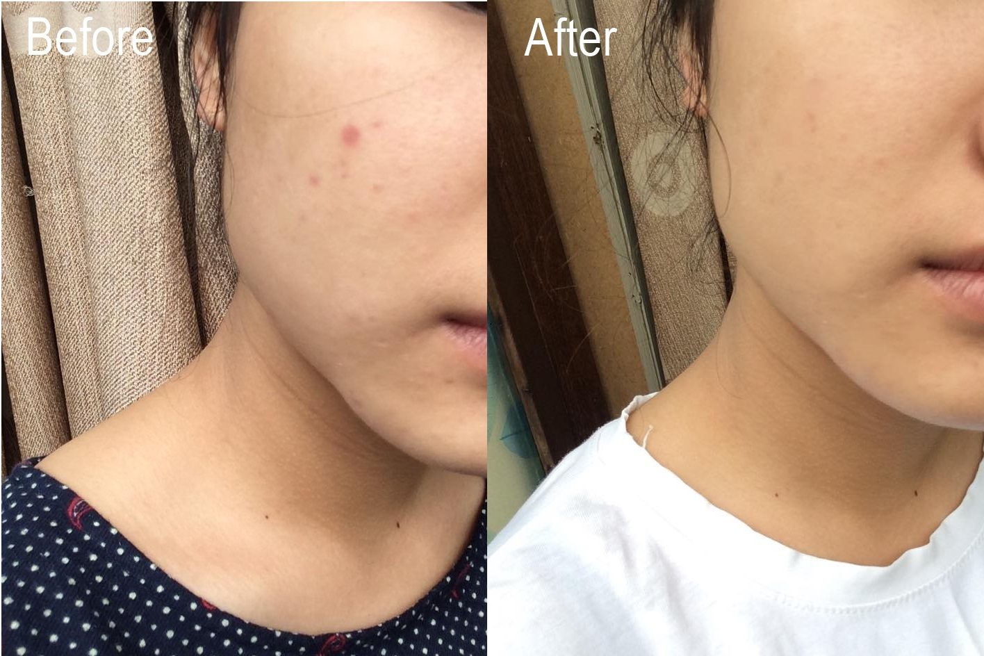 Kinh nghiệm skin care tuổi 30 của tôi: Không bao giờ dùng duy nhất một loại toner và loại nào cũng dưới 300k - Ảnh 14.