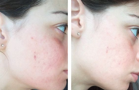 Kinh nghiệm skin care tuổi 30 của tôi: Không bao giờ dùng duy nhất một loại toner và loại nào cũng dưới 300k - Ảnh 3.