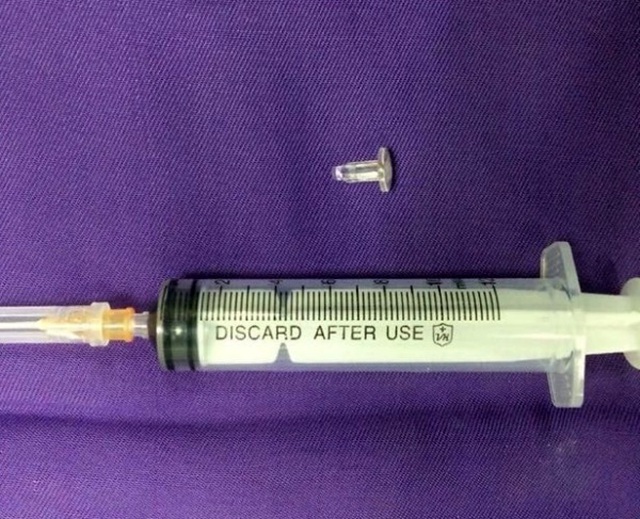 B&eacute; 9 tuổi ở Quảng Ninh t&iacute;m t&aacute;i v&igrave; đầu b&uacute;t bi g&acirc;y b&iacute;t tắc phế quản - Ảnh 1.