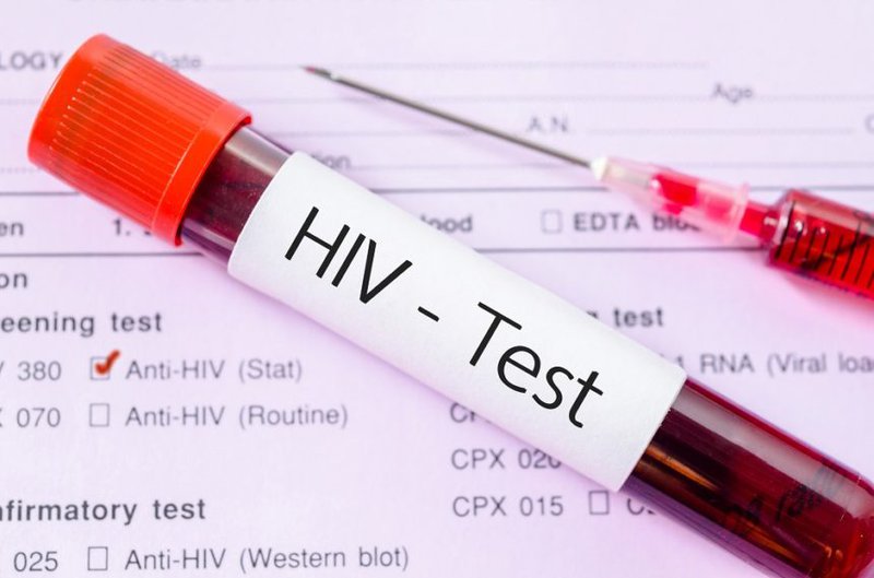 &quot;Bí mật trong máu tôi&quot;: Bi kịch cuộc đời của cậu bé nhiễm HIV mà không dám tiết lộ với bất kỳ ai, án tử đến từ mũi tiêm chữa bệnh và cú lội ngược dòng ngoạn mục - Ảnh 3.