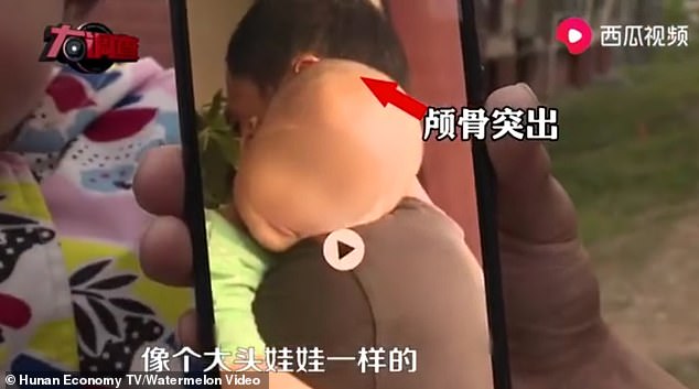 Trẻ em Trung Quốc đột nhiên mắc bệnh &quot;đầu to&quot; sau khi uống một loại &quot;sữa bột đặc biệt&quot; được bày bán trong một cửa hàng mẹ và bé nổi tiếng - Ảnh 1.