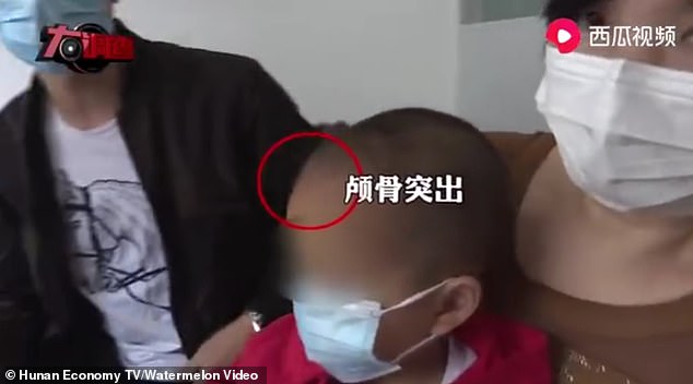 Trẻ em Trung Quốc đột nhiên mắc bệnh &quot;đầu to&quot; sau khi uống một loại &quot;sữa bột đặc biệt&quot; được bày bán trong một cửa hàng mẹ và bé nổi tiếng - Ảnh 2.