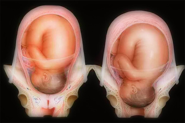 Những điều cơ bản mẹ bầu cần biết về khám cổ tử cung khi chuyển dạ - Ảnh 2.