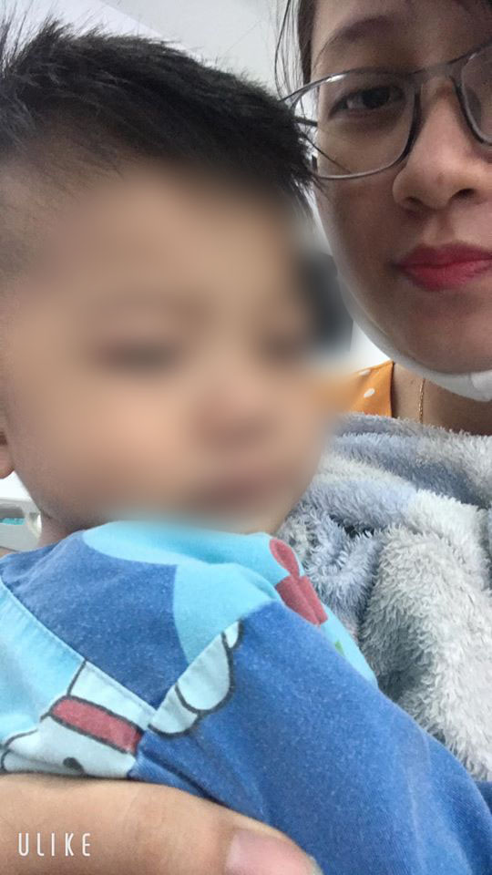 Bé trai 22 tháng tuổi hầu như chưa nói được gì, mẹ đưa đi khám, không ngờ con bị dính thắng lưỡi phải phẫu thuật - Ảnh 2. Bé trai 22 tháng tuổi hầu như chưa nói được gì, mẹ đưa đi khám, không ngờ con bị dính thắng lưỡi phải phẫu thuật - Ảnh 2.