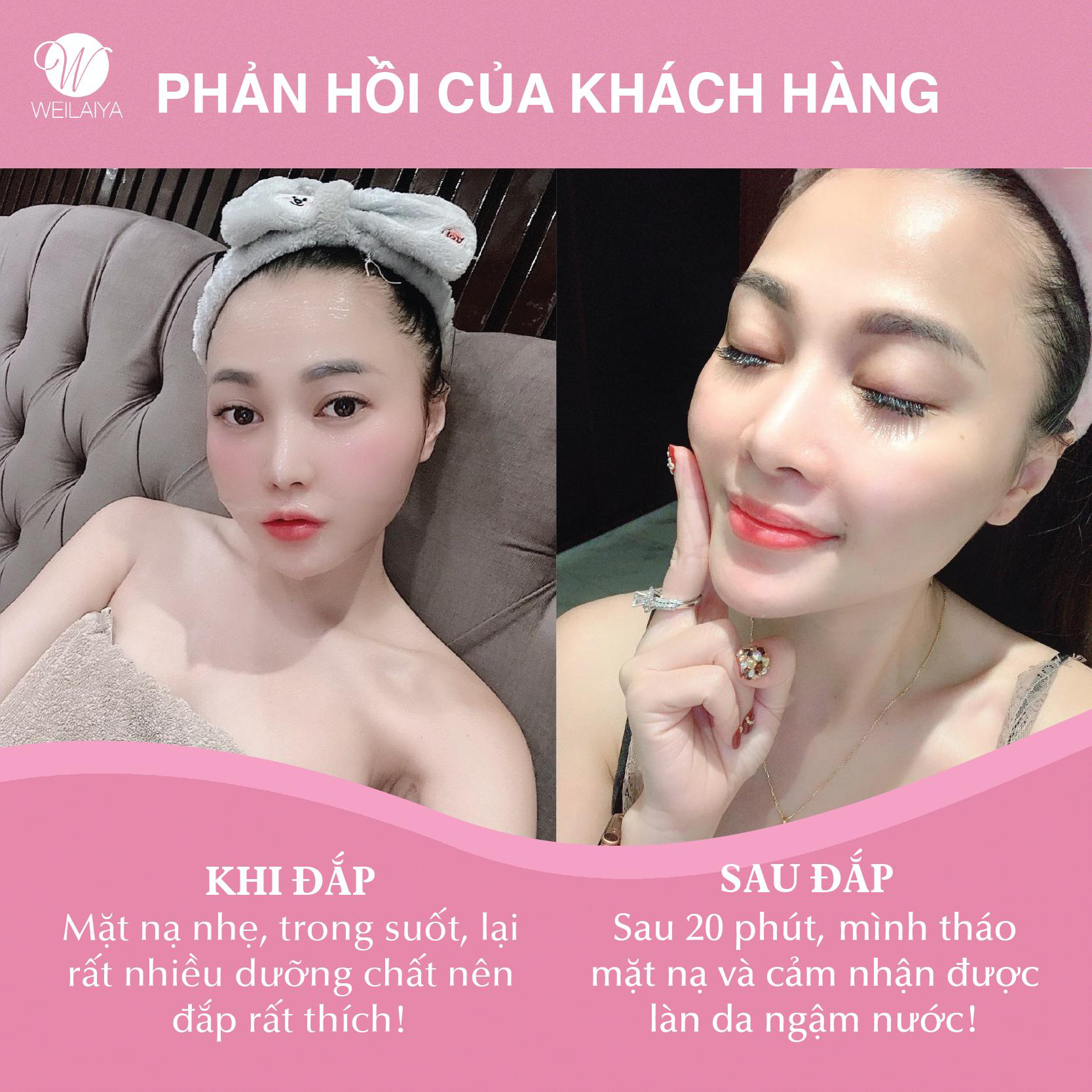 Bạn c&oacute; biết loại mặt nạ n&agrave;o đang dậy s&oacute;ng trong giới l&agrave;m đẹp hiện nay? - Ảnh 4.