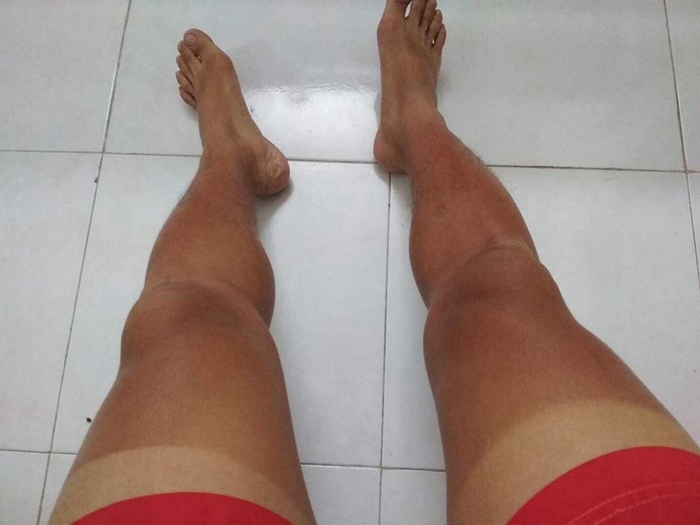 Sốc to&agrave;n tập với những h&igrave;nh ảnh ''ch&aacute;y nắng'' đầu h&egrave; khiến cộng đồng mạng vừa ngỡ ng&agrave;ng vừa lo lắng kh&ocirc;ng th&ocirc;i - Ảnh 8.