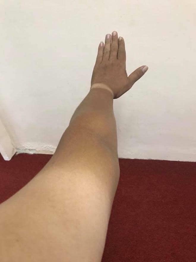 Sốc to&agrave;n tập với những h&igrave;nh ảnh ''ch&aacute;y nắng'' đầu h&egrave; khiến cộng đồng mạng vừa ngỡ ng&agrave;ng vừa lo lắng kh&ocirc;ng th&ocirc;i - Ảnh 4.