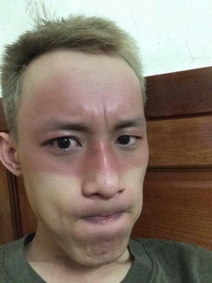 Sốc to&agrave;n tập với những h&igrave;nh ảnh ''ch&aacute;y nắng'' đầu h&egrave; khiến cộng đồng mạng vừa ngỡ ng&agrave;ng vừa lo lắng kh&ocirc;ng th&ocirc;i - Ảnh 6.