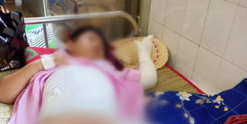 Một nhóm người ném bom xăng rồi ngăn không cho người dân chữa cháy, hai đứa trẻ bị bỏng nặng - Ảnh 4. Một nhóm người ném bom xăng rồi ngăn không cho người dân chữa cháy, hai đứa trẻ bị bỏng nặng - Ảnh 4.