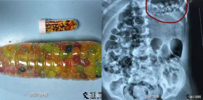 Lời cảnh báo tới cha mẹ về thứ đồ chơi được nhà sản xuất ghi là an toàn, không độc hại nhưng khiến bé trai ăn gì nôn nấy, suýt tắc ruột - Ảnh 3. Lời cảnh báo tới cha mẹ về thứ đồ chơi được nhà sản xuất ghi là an toàn, không độc hại nhưng khiến bé trai ăn gì nôn nấy, suýt tắc ruột - Ảnh 3.