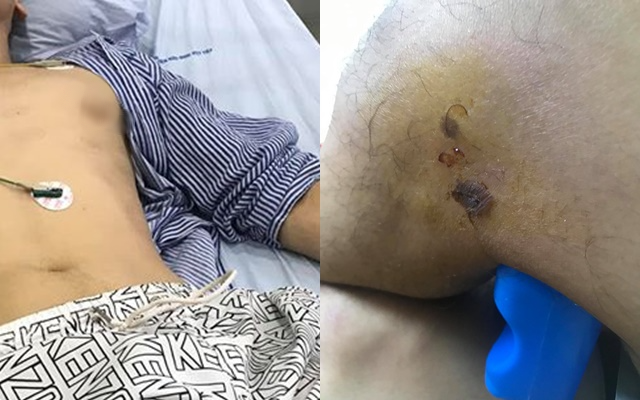 Cho chồng nu&ocirc;i c&aacute; cảnh, c&ocirc; vợ hốt hoảng đưa đi cấp cứu v&igrave; bị c&aacute; độc đ&acirc;m v&agrave;o người - Ảnh 2.