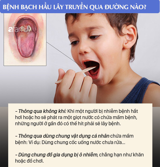 2 bé ở Đắk Nông mắc bệnh bạch hầu: Những điều cần biết về bệnh nhiễm trùng dễ dàng qua đường hô hấp này để phòng bệnh tốt nhất - Ảnh 4.